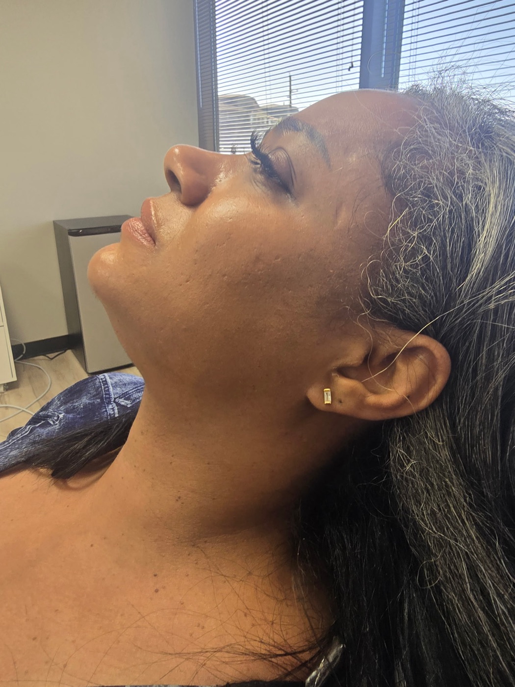 Liquid Lipo