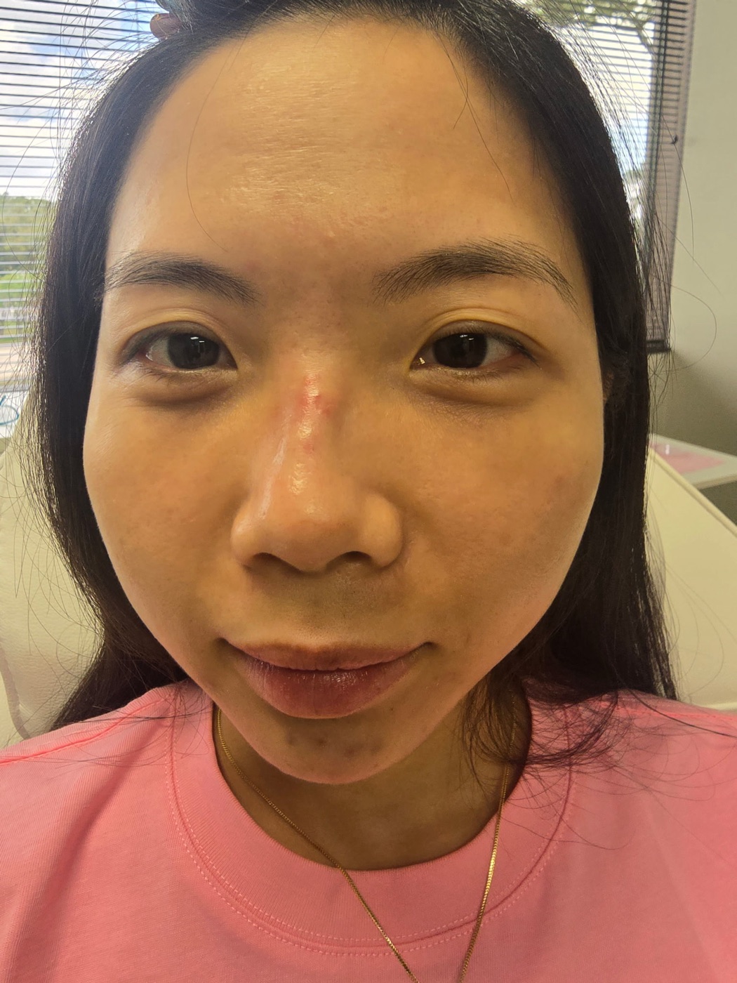 Liquid Lipo