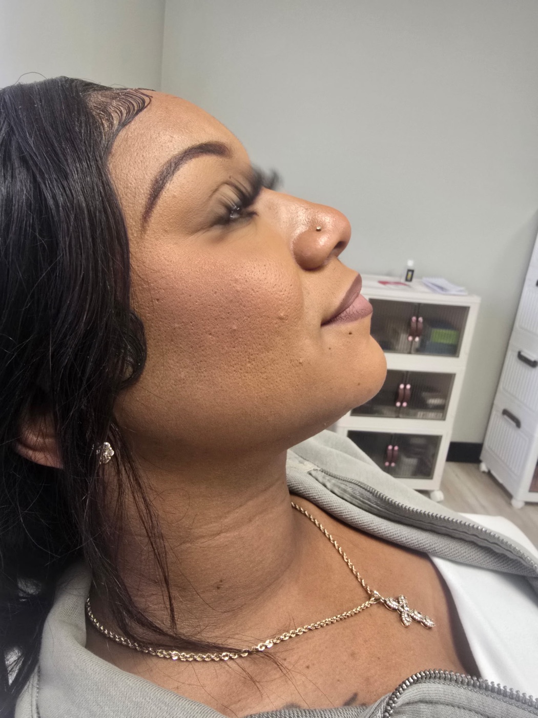 Nefertiti Lift