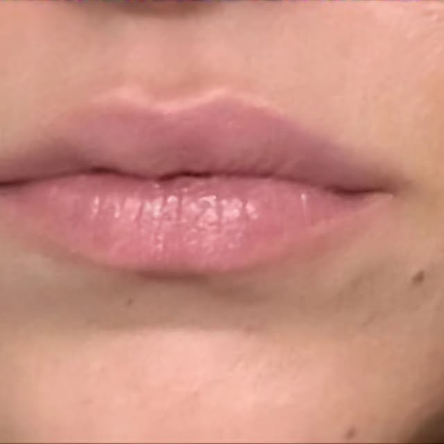 CResultsBeauty gallery photo 16