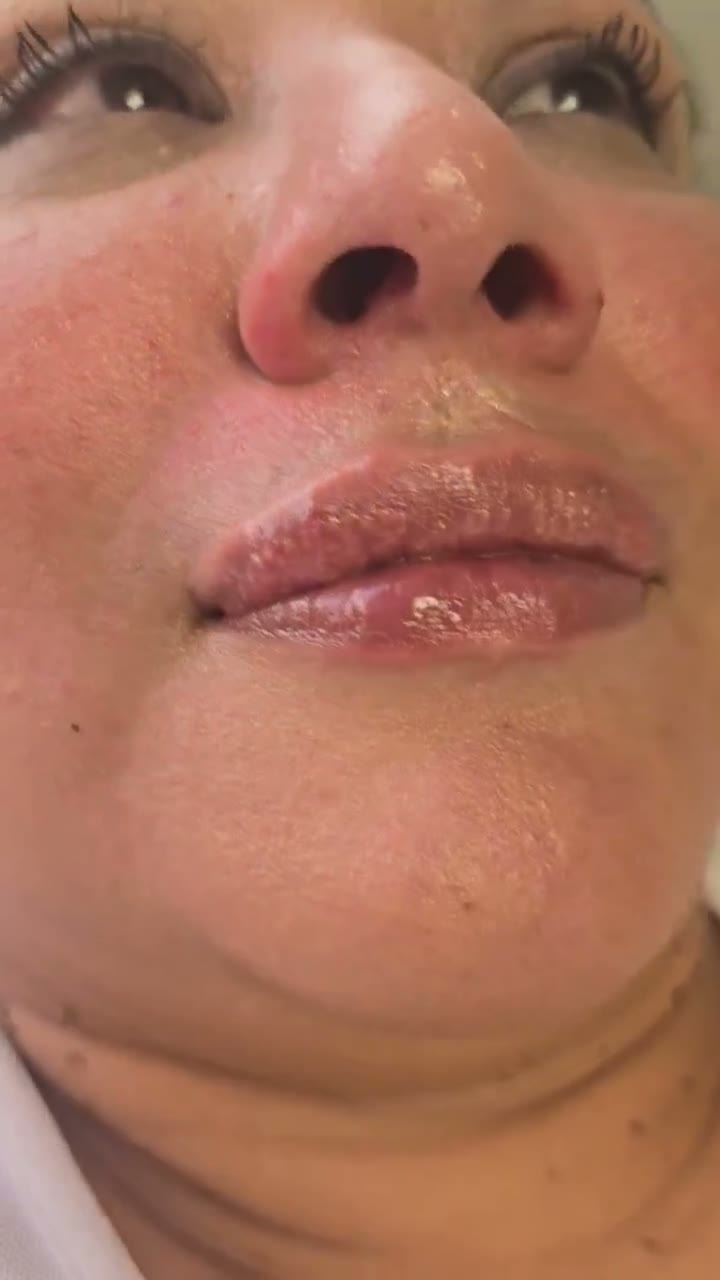 Video 5 preview
